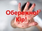 Як розпізнати, що людина заразилася кором?
