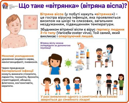 Вітряна віспа або вітрянка: що це за захворювання